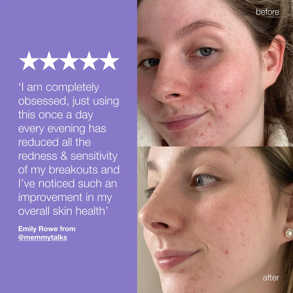 Dermalogica Ultra Calming Stablizing Repair Cream - Image 4