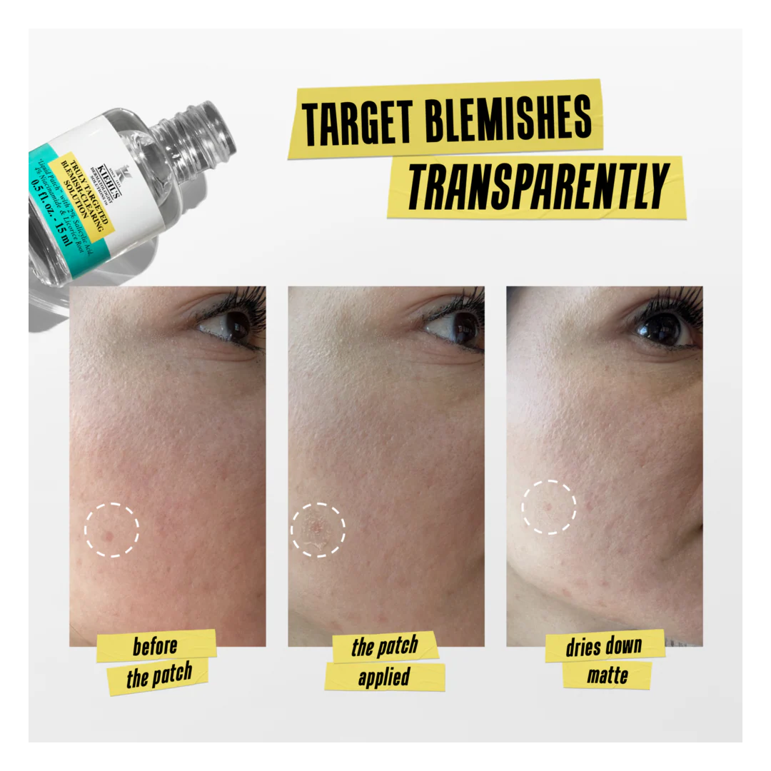 Kiehl's Truly Targeted Blemish-Clearing Solution - Image 4