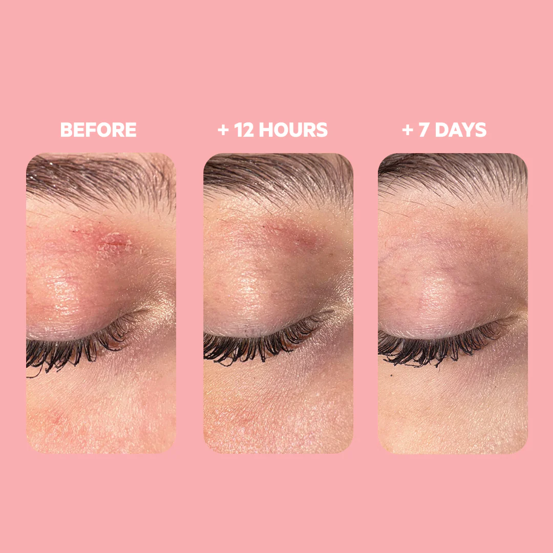 SVR Palpebral Balm - Image 5