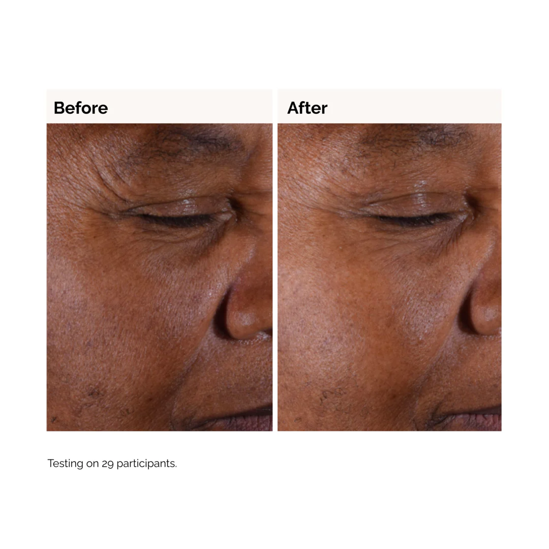 The Ordinary Glycolic Acid 7% Exfoliating Toner - Image 3